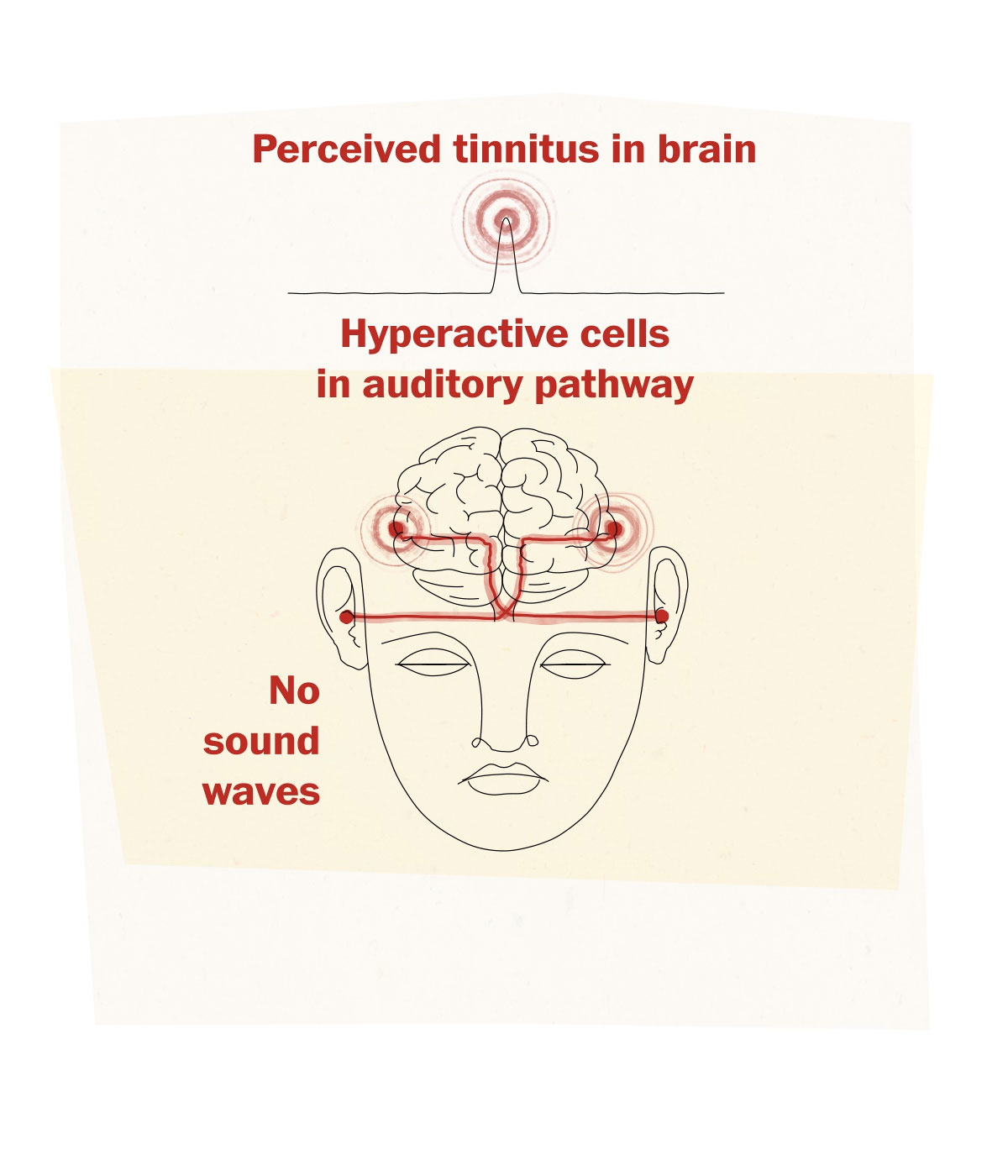 Tinnitus - its potential causes, and how to manage it - Lifestyle Hearing  Solutions