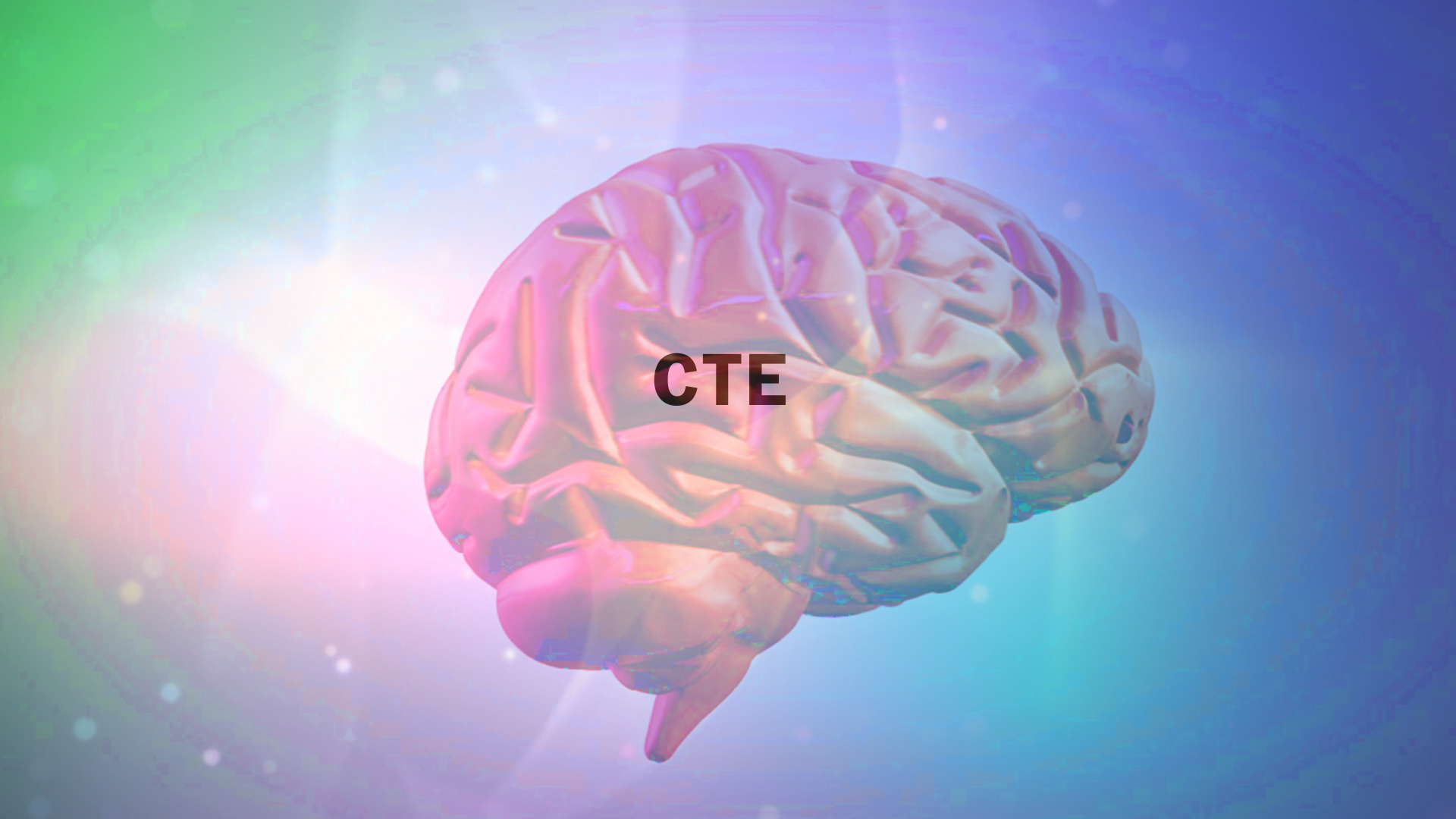 CTE found in 99 percent of former NFL players' brains donated in new study  