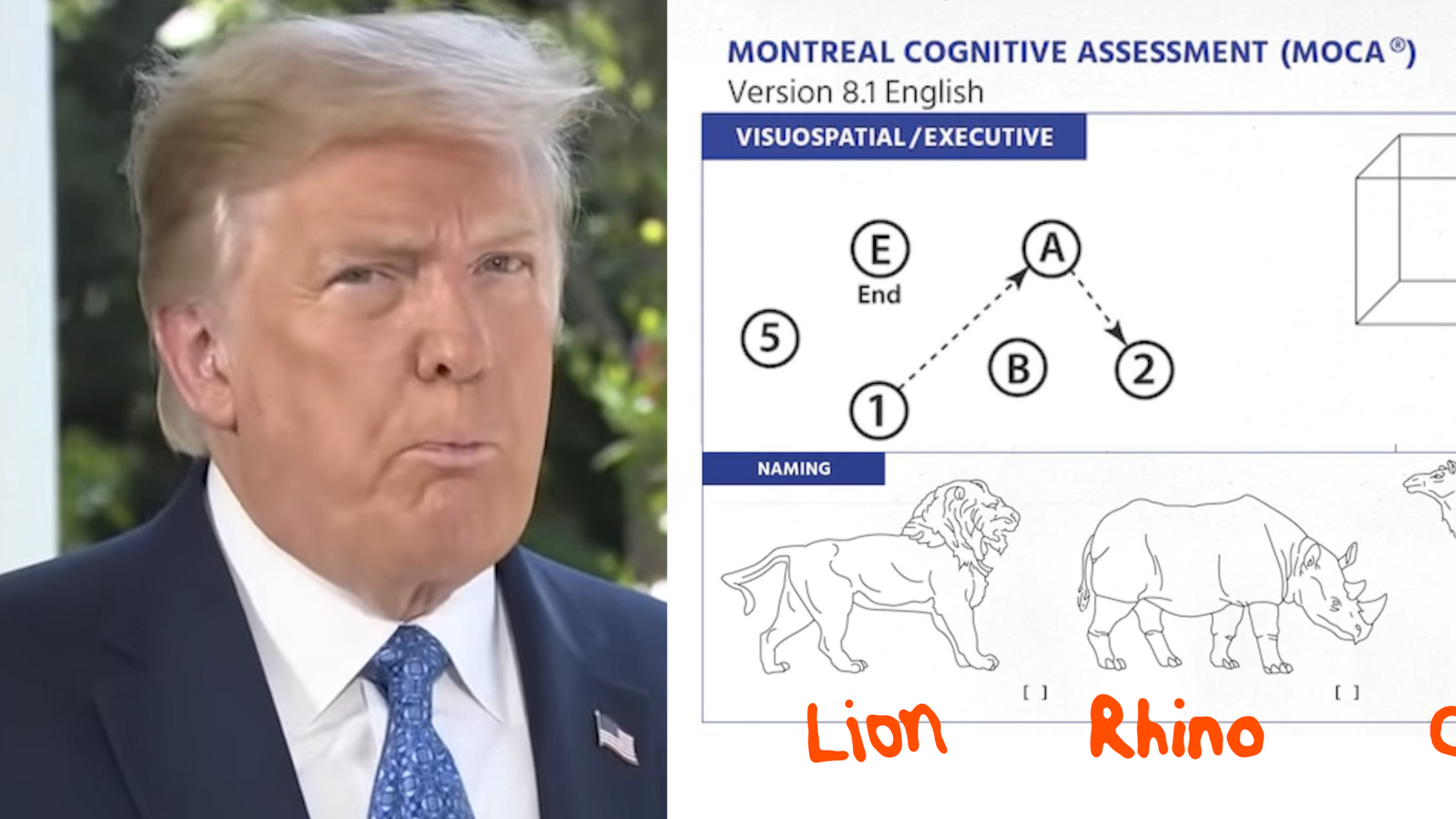 Montreal Cognitive Assessment Trump brags about is a traumatic experience people with dementia The Washington Post