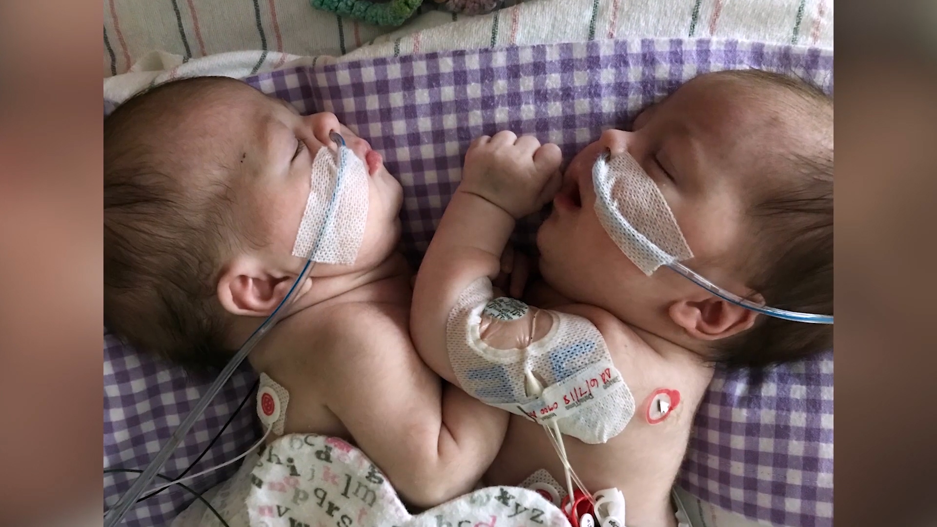 Conjoined Twins Jesi And Remi Pitre Are Finally Going Home To Apopka Fla In Separate Car Seats The Washington Post