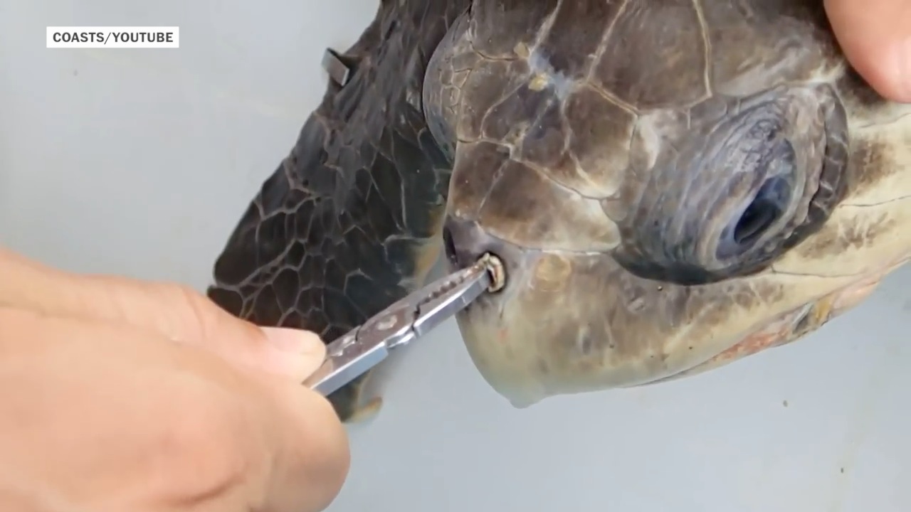 MTN 147: Plastic Straw Found Inside the Nostril of an Olive Ridley