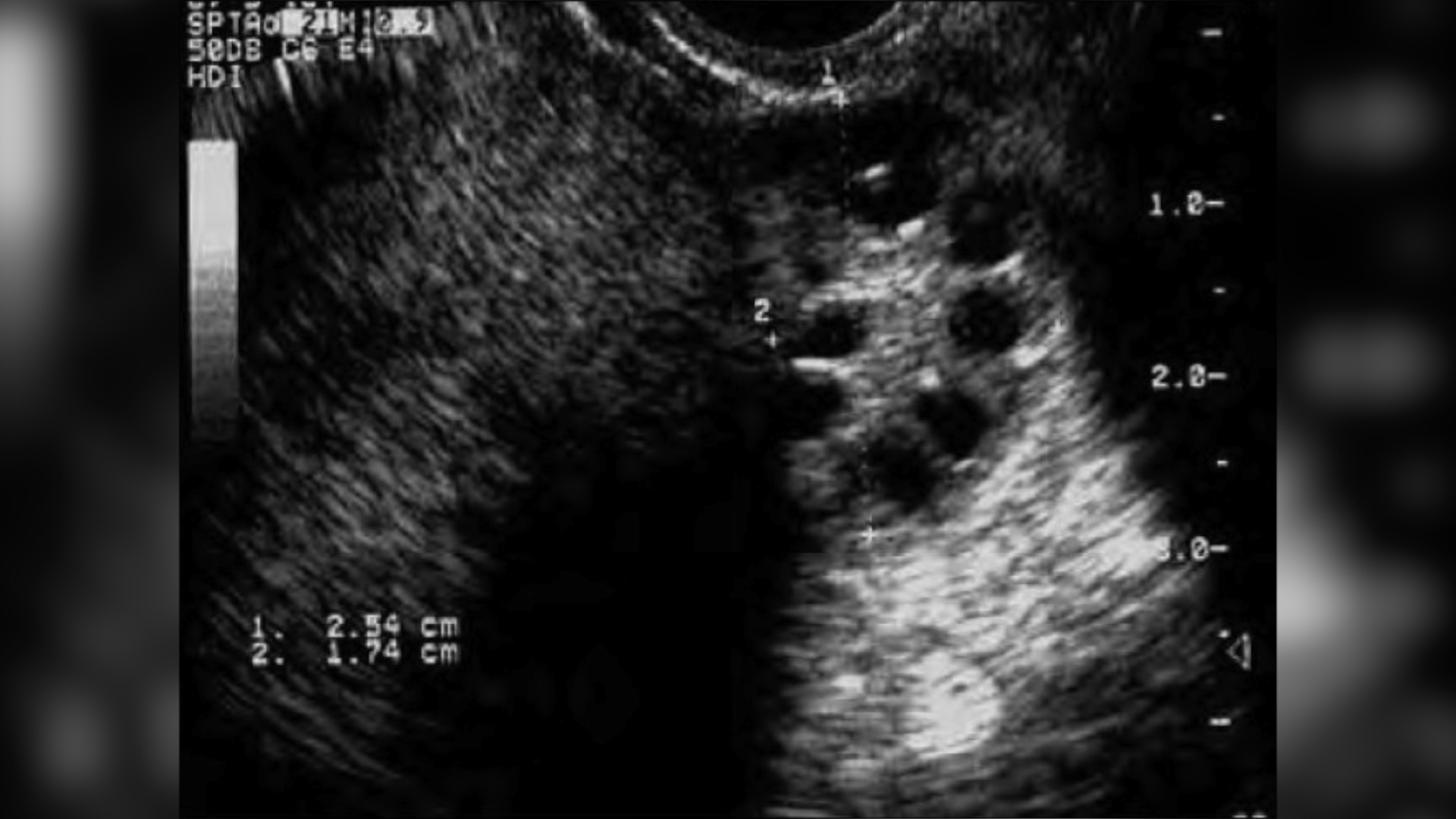 Louis Vuitton Mini Mini Pochette Tissu Louis Vuitton Mini Pochette